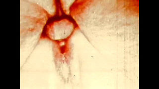 The Appetizing Sucker