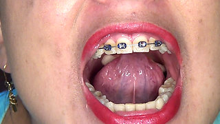 Playing and Swallowing Gummy Eggs