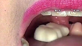 Swallowing Lots of Gummi Bears at Same Time!!