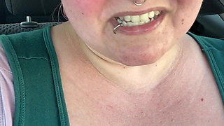 Got a Sunburn for Art Supplies!