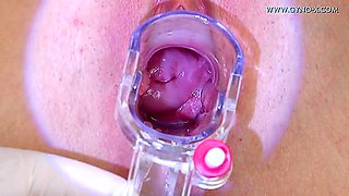 Senior Fat Gyno Doctor Looks At The Undressing Young Woman